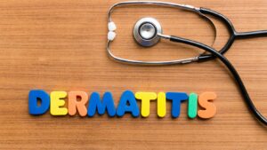 Dermatitis: Symptoms and Types