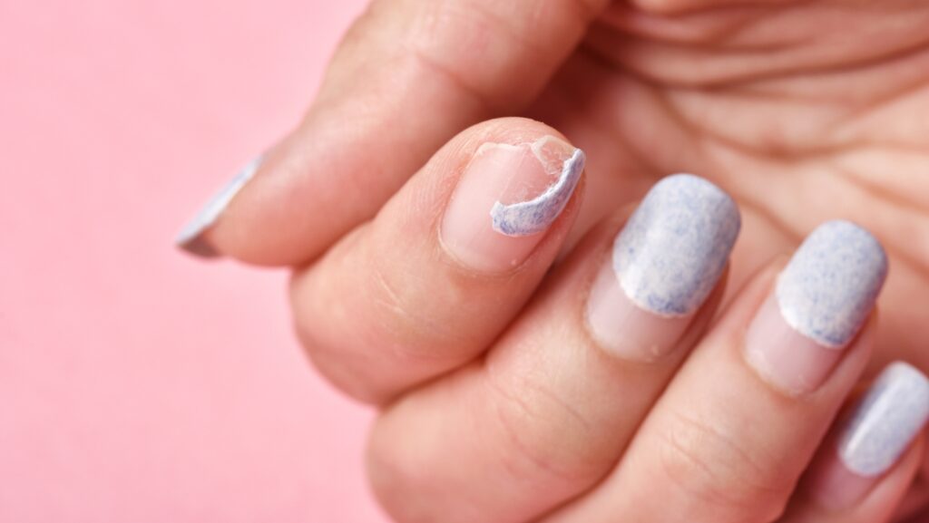 what to do when your acrylic nail rips off your real nail