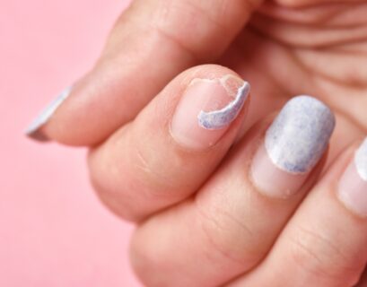 what to do when your acrylic nail rips off your real nail