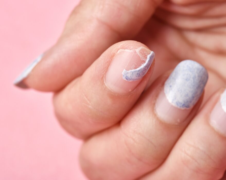 what to do when your acrylic nail rips off your real nail